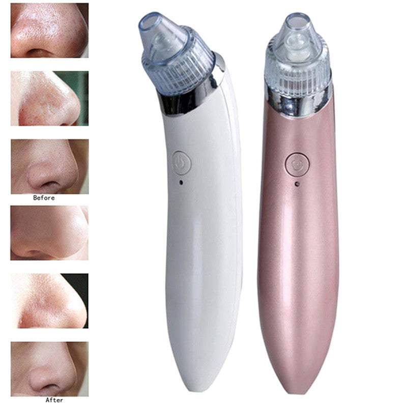 2-in-1 Pore Cleanser and Microdermabrasion Device | KILPOR 2.0