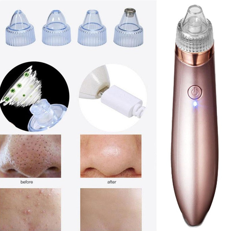 2-in-1 Pore Cleanser and Microdermabrasion Device | KILPOR 2.0